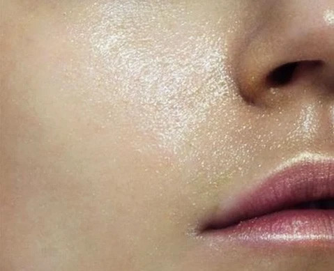 Đặc Điểm và Cách Chăm Sóc Cho Da Dầu Hiệu Quả