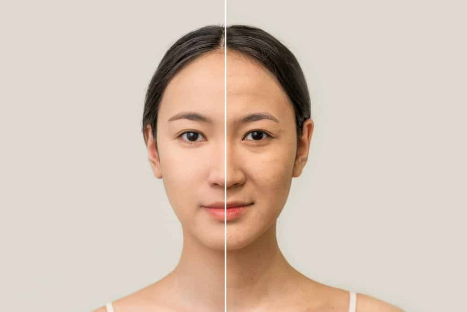 Đối Mới Da: Nguyên Nhân, Cách Điều Trị và Phòng Ngừa Hiệu Quả