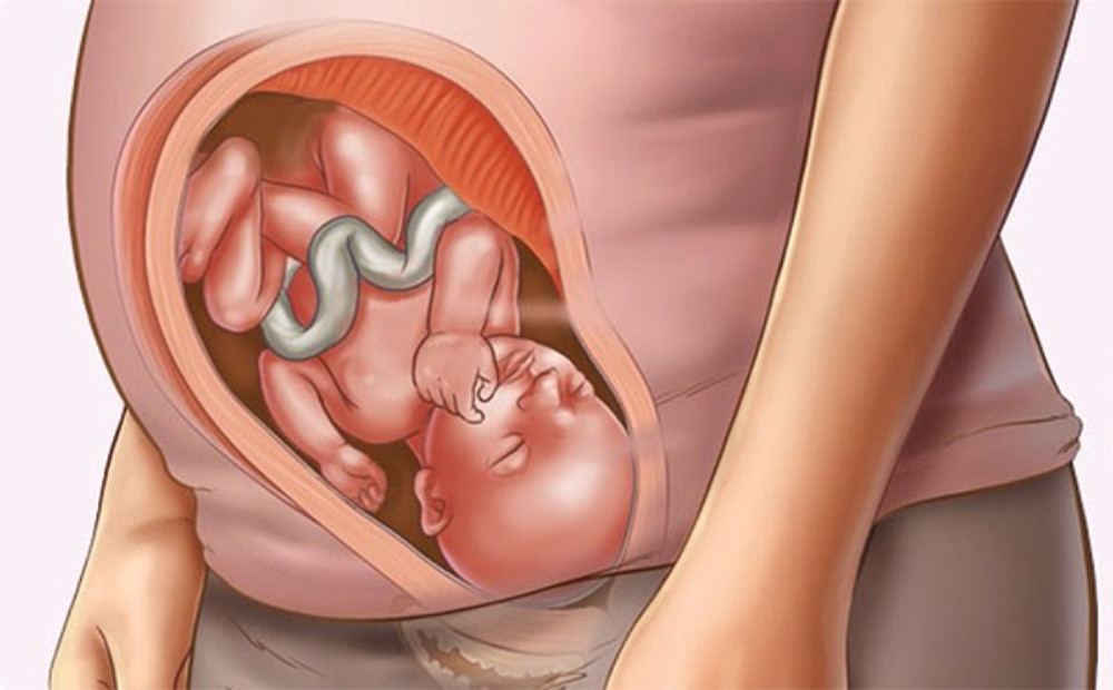 Gạo Lứt Đen: 13 Tác Dụng Tuyệt Vời Cho Sức Khỏe