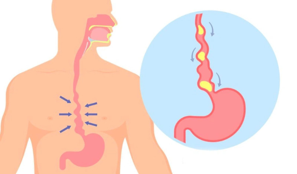 Gạo Lứt Đen: 13 Tác Dụng Tuyệt Vời Cho Sức Khỏe