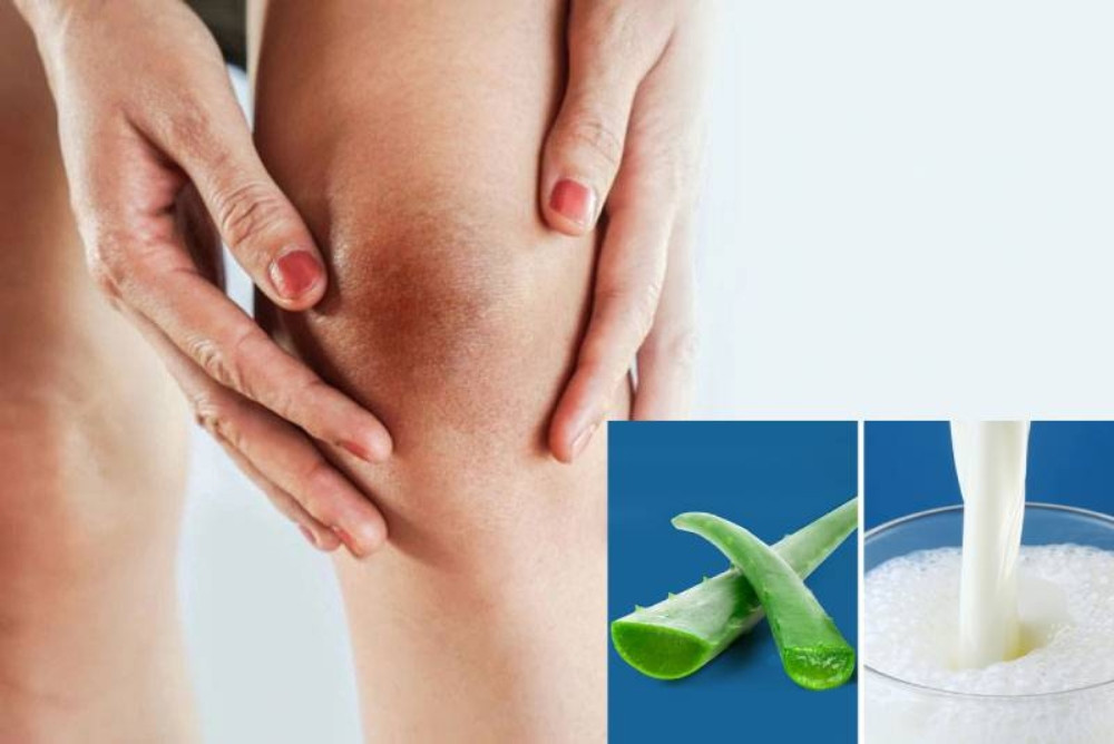 Hướng dẫn 12 cách làm trắng đầu gối, khuỷu tay nhanh chóng, dễ thực hiện