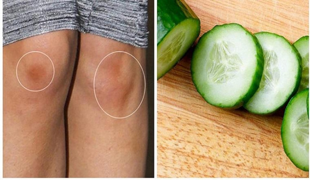Hướng dẫn 12 cách làm trắng đầu gối, khuỷu tay nhanh chóng, dễ thực hiện