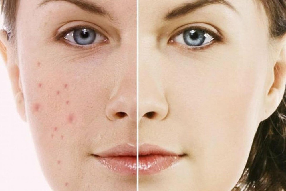 Hướng dẫn cách sử dụng kem dưỡng da từ A đến Z đúng chuẩn