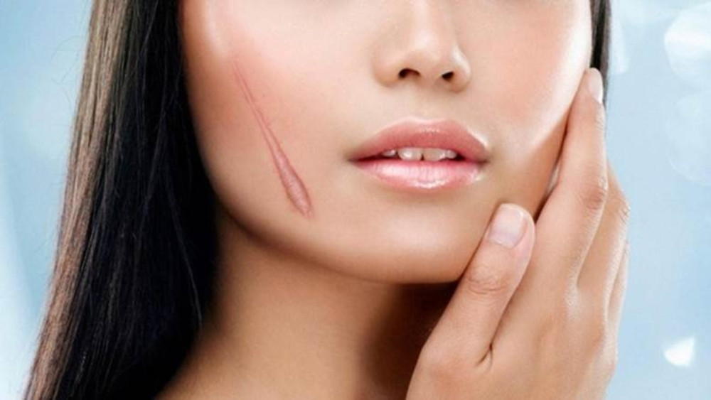 Khám Phá 10 Công Dụng Của Rau Má Trong Làm Đẹp