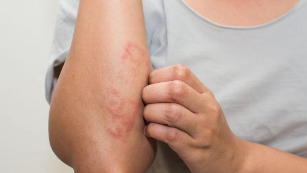 Khám Phá 10 Công Dụng Của Rau Má Trong Làm Đẹp