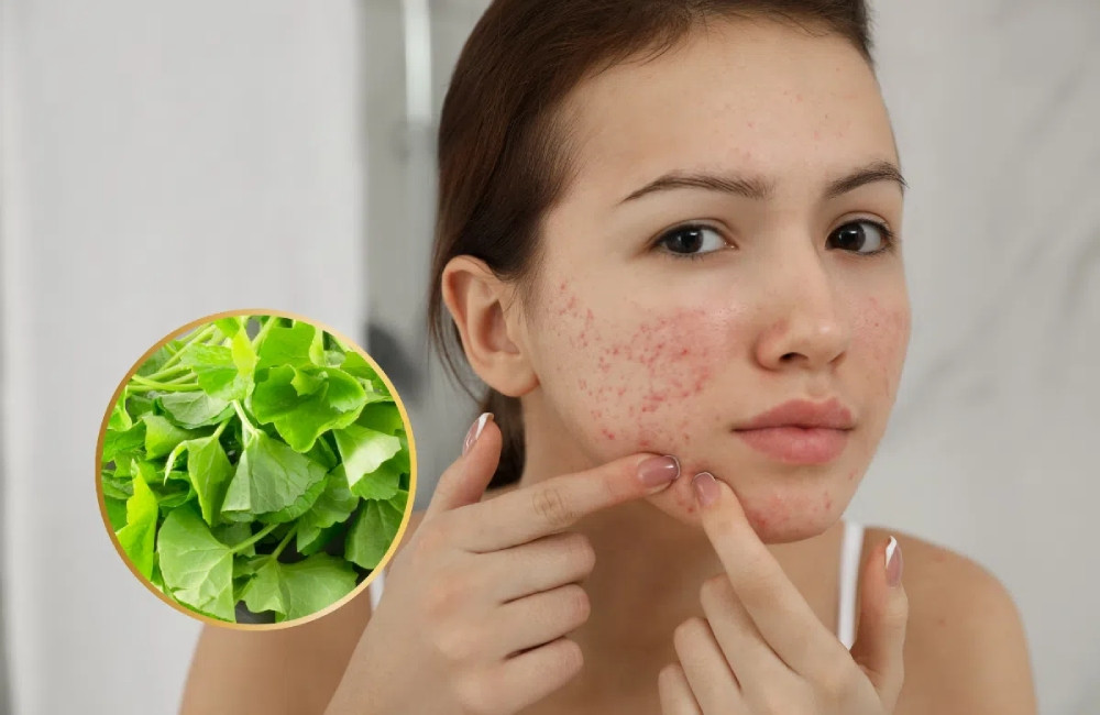 Khám Phá 10 Công Dụng Của Rau Má Trong Làm Đẹp