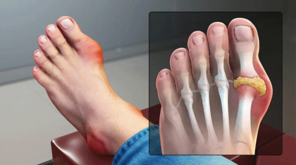 Khám Phá 11 Tác Dụng Của Gạo Lứt Rang Và Đậu Đen Tốt Cho Sức Khỏe