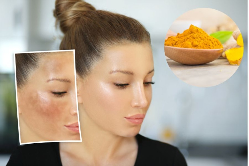 Khám Phá 7 Tác Dụng Tuyệt Vời Của Nghệ Và Mật Ong Trong Làm Đẹp