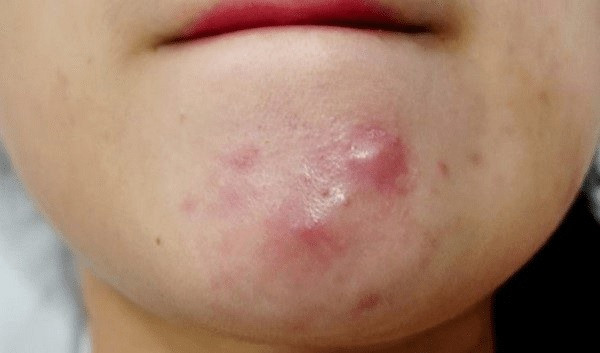 Klenzit C: Những Cảnh Báo Cần Lưu Ý Khi Sử Dụng