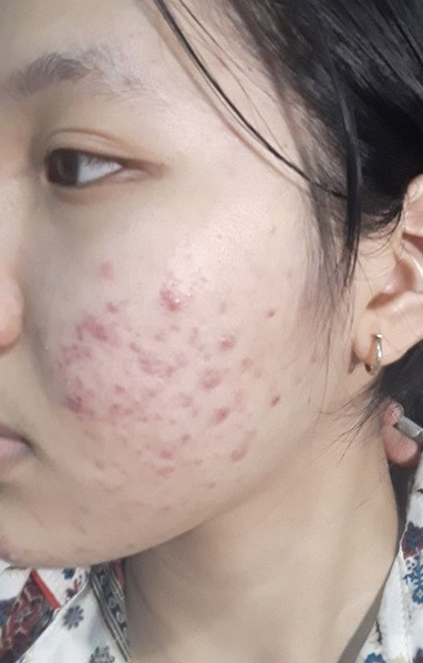 Klenzit C: Những Cảnh Báo Cần Lưu Ý Khi Sử Dụng