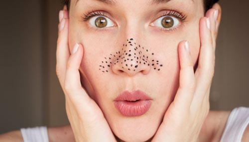 Mụn trứng cá: Nguyên nhân, cách nhận biết và giải pháp hiệu quả