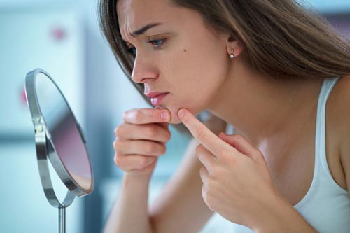 Mụn trứng cá: Nguyên nhân, cách nhận biết và giải pháp hiệu quả