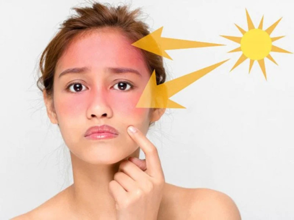 Nguy cơ tiềm ẩn khi không sử dụng kem chống nắng