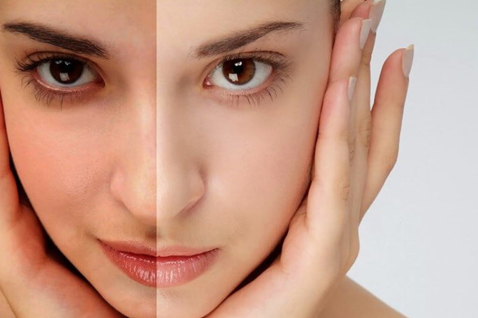 Nguy cơ tiềm ẩn khi không sử dụng kem chống nắng