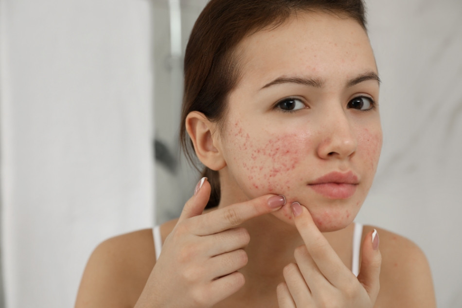 Nguy cơ tiềm ẩn khi không sử dụng kem chống nắng