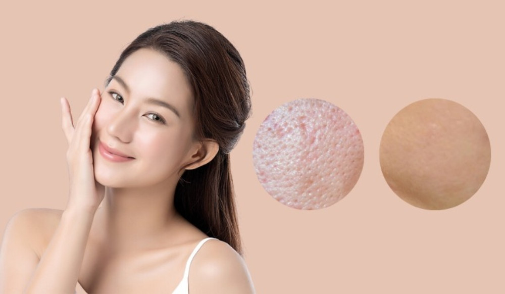 Nha Đam &#8211; Siêu Phẩm Làn Da Mặt Bạn Không Thể Bỏ Qua