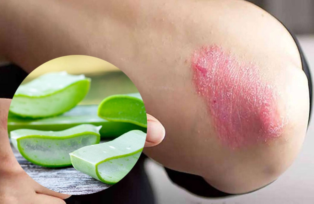Nha Đam &#8211; Siêu Phẩm Làn Da Mặt Bạn Không Thể Bỏ Qua