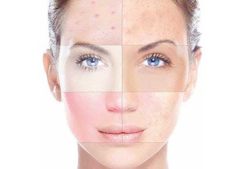 [NHẬN BIẾT] Phân biệt loại da? 2 Cách nhận biết làn da của bạn đơn giản