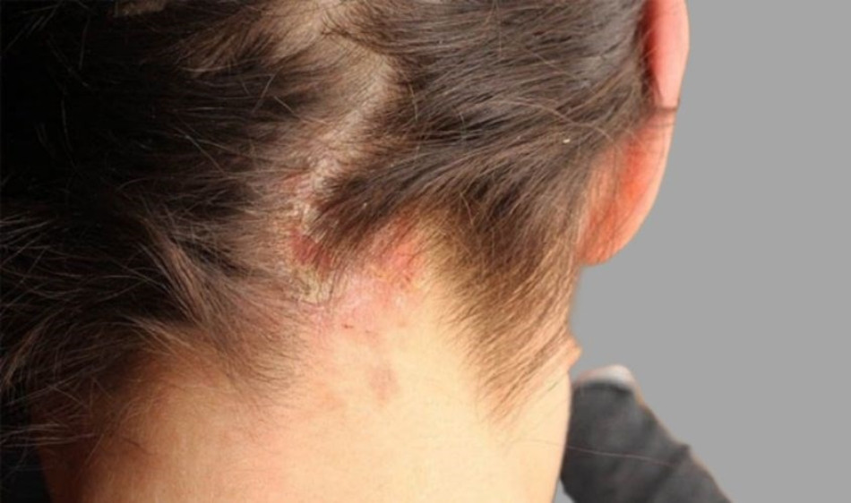Sữa tắm có gội đầu được không? Những nguy cơ có thể gặp phải