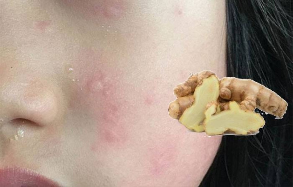 Tác Dụng Của Nghệ Trắng Trong Làm Đẹp Mà Bạn Chưa Biết