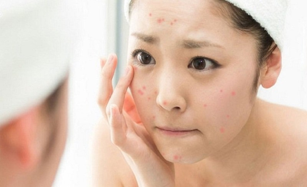 Tác Dụng Tuyệt Vời Của Dầu Dừa Trong Chăm Sóc Da
