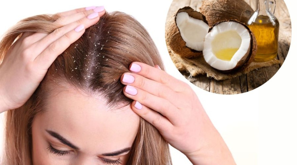 Tại Sao Nhuộm Tóc Xong Bị Gàu? 5 Cách Khắc Phục Hiệu Quả