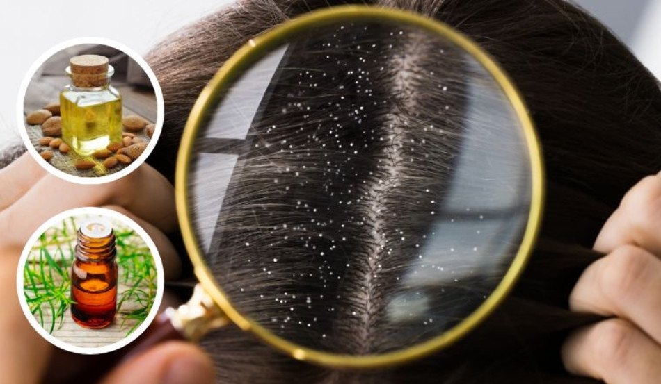 Tại Sao Nhuộm Tóc Xong Bị Gàu? 5 Cách Khắc Phục Hiệu Quả