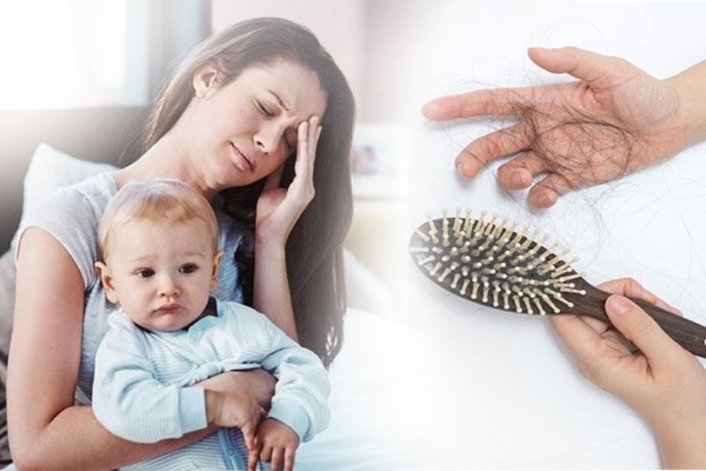 Thời Điểm Vàng Làm Đẹp Sau Sinh Cho Mẹ Bầu