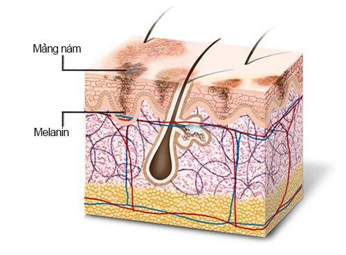Vitamin C là gì? Công dụng của Vitamin C trong làm đẹp